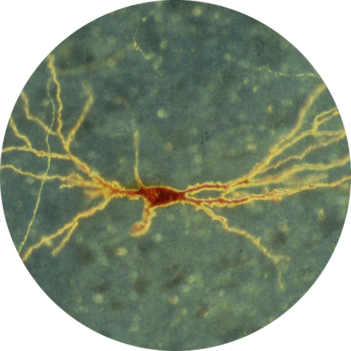 A picture of an image with the neurons in it.